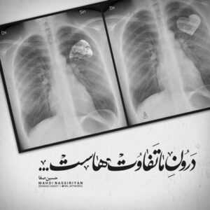 دانلود آهنگ صدای پا نبود صدای تق تق شکستن تو بود غروب خسته بود محسن چاوشی